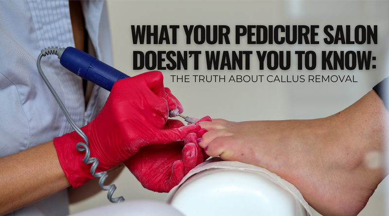 What Your Pedicure Salon Doesn’t Want You to Know: The Truth About Callus Removal