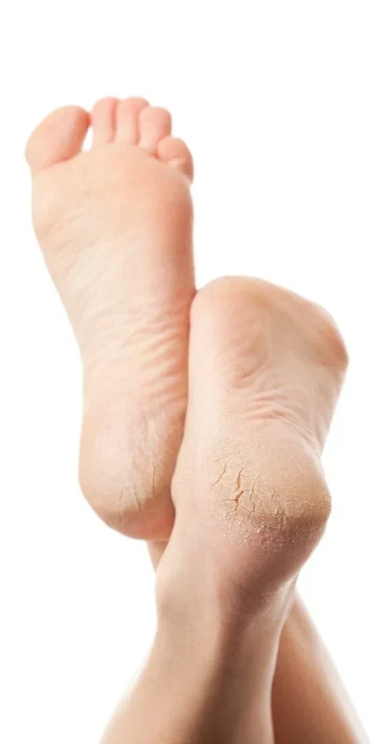 What Standing or Walking All Day at Work Does to Your Heels