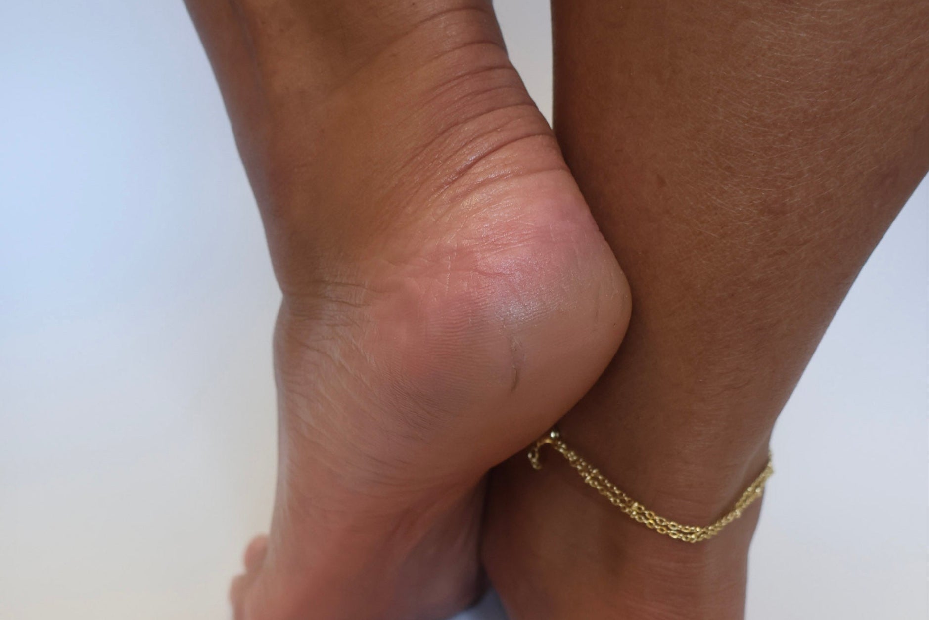 Beautiful heel that has been healed by the Heel Revival Regimen. No more cracks or overly thick callus. Just a soft smooth hydrated foot.