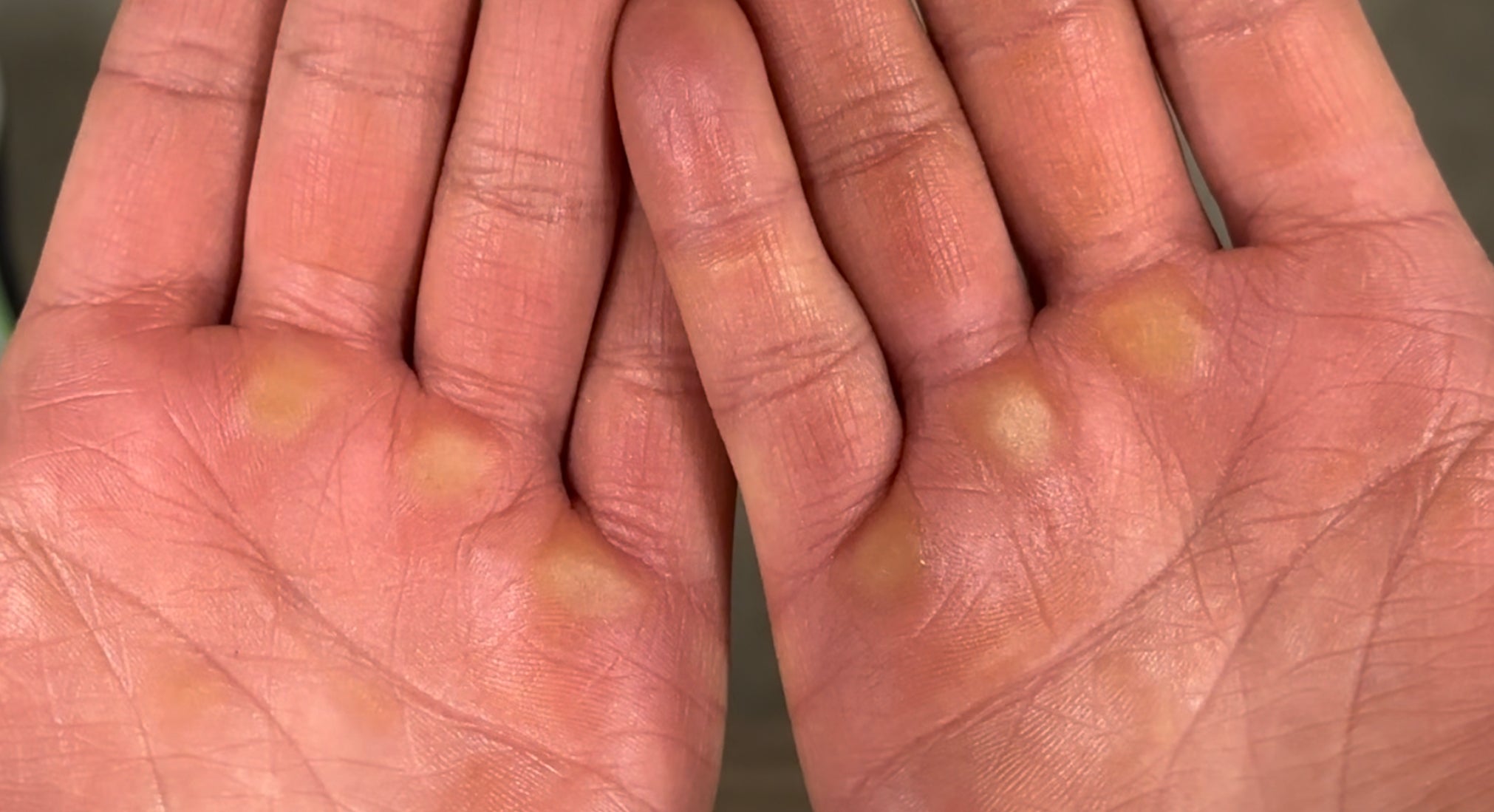 Picture of hands after using the SandBar