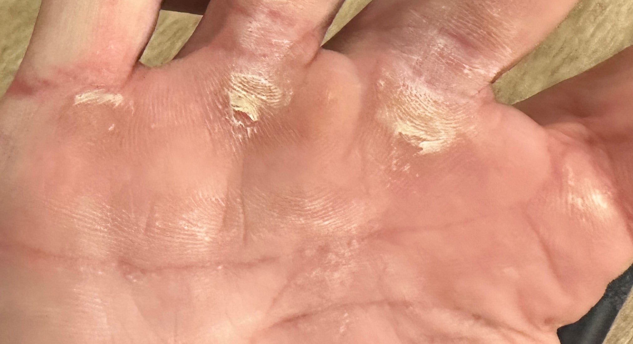 Picture of hands before using the SandBar