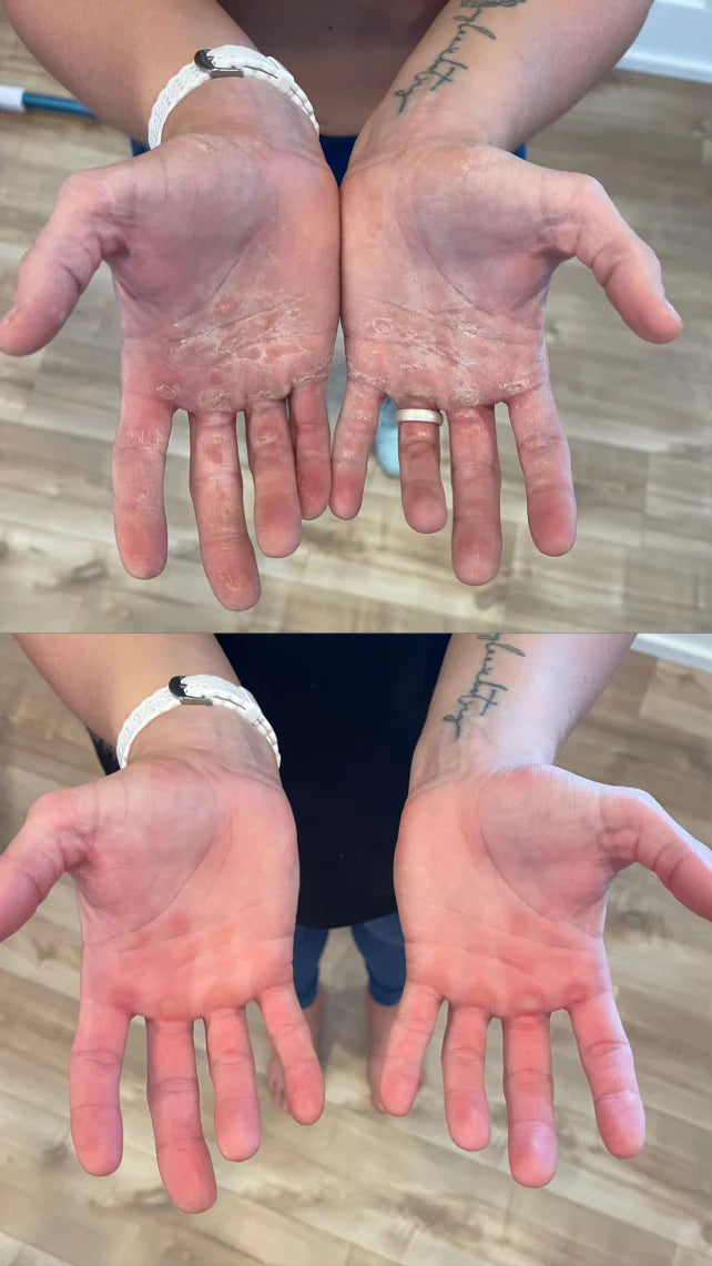 Before and After shots of hands that are beat up after a hard workout. Thick calluses. Next to the After image where they have used the sandbar callus file and salve and have healthy smooth, moisturized hands.