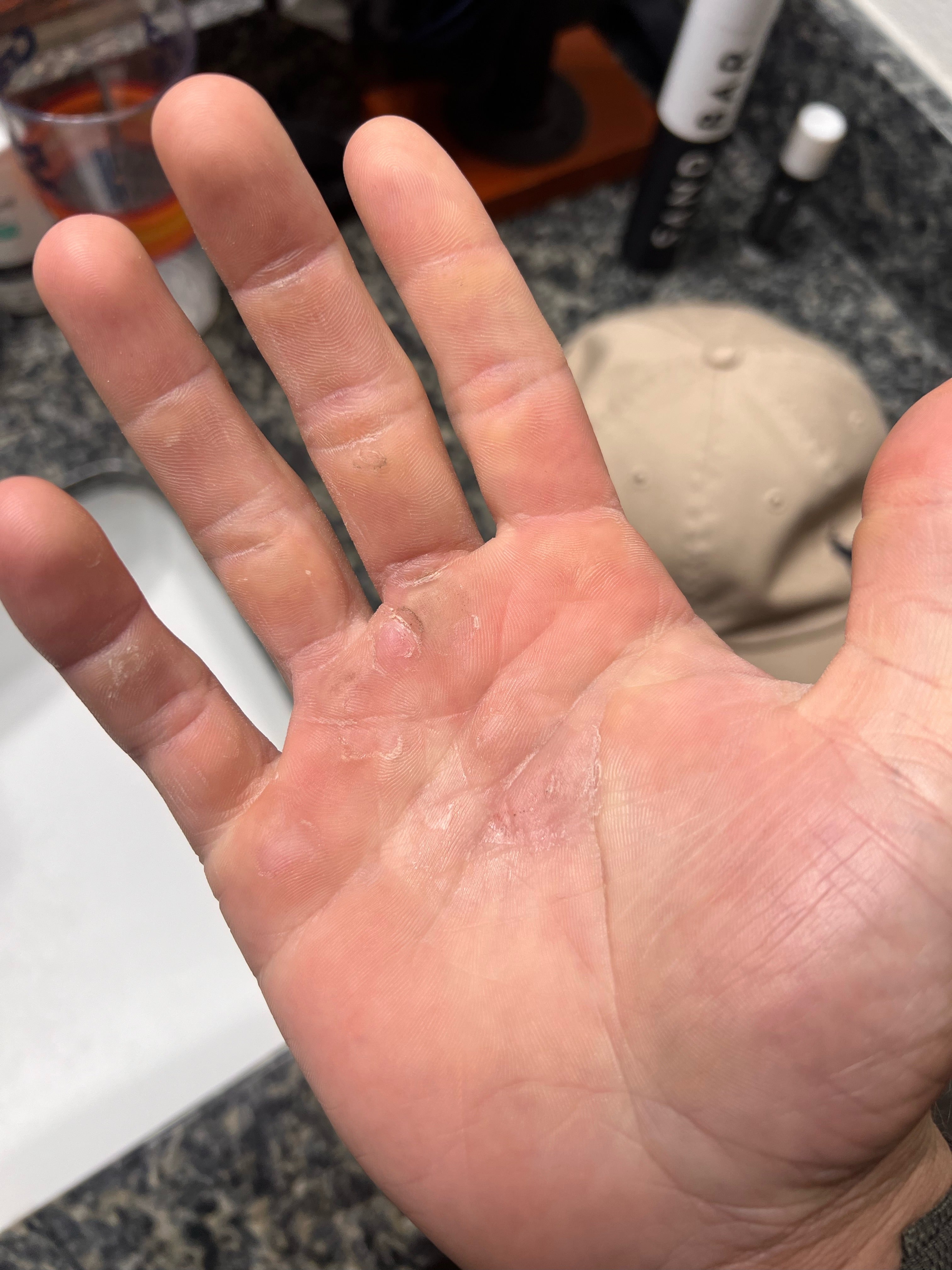 AFTER: A hand that was once ripped and callused, now smooth and well maintained after using the SandBar Callus file and Salve.