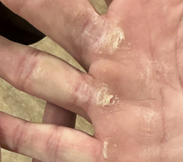 Mastering Callus Care: 3 Indicators Your Calluses Need Attention