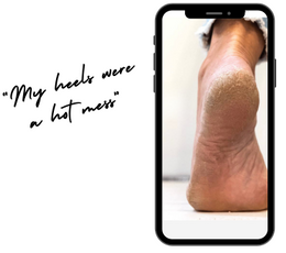 The Making of the Heel Revival Regimen Kit: My Discovery to Healthy, Beautiful Feet