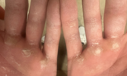 LOVE YOUR CALLUSES: The Essential Guide to Callus Care for Gritty Athletes