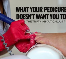 What Your Pedicure Salon Doesn’t Want You to Know: The Truth About Callus Removal