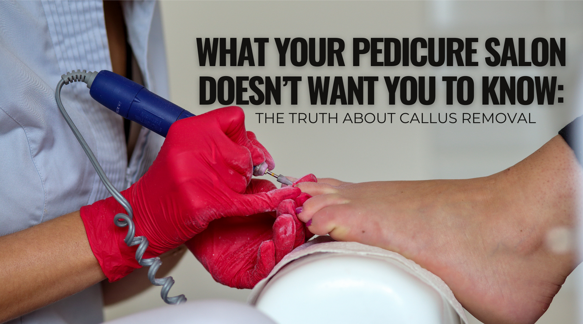 What Your Pedicure Salon Doesn’t Want You to Know: The Truth About Callus Removal