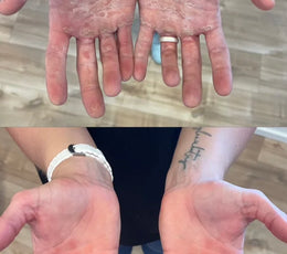 Best Tools for Grip Athletes to Maintain Their Calluses