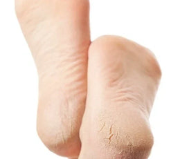 What Standing or Walking All Day at Work Does to Your Heels