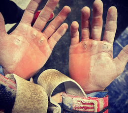 LOVE YOUR CALLUSES: The Essential Guide to Callus Care for Gritty Athletes