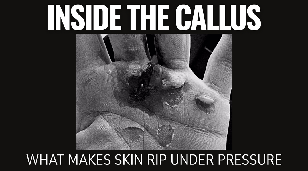 Inside the Callus: What Makes Skin Rip Under Pressure