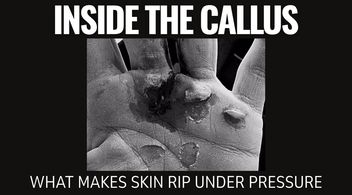 Inside the Callus: What Makes Skin Rip Under Pressure