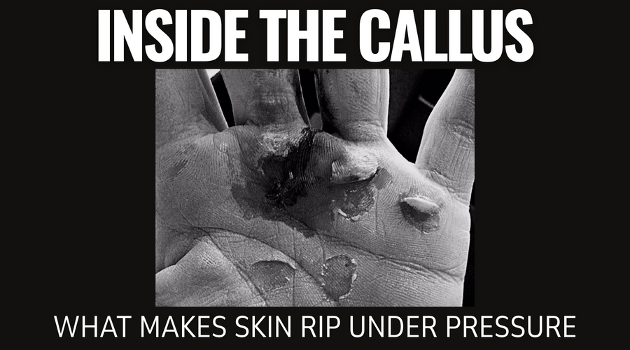 Inside the Callus: What Makes Skin Rip Under Pressure
