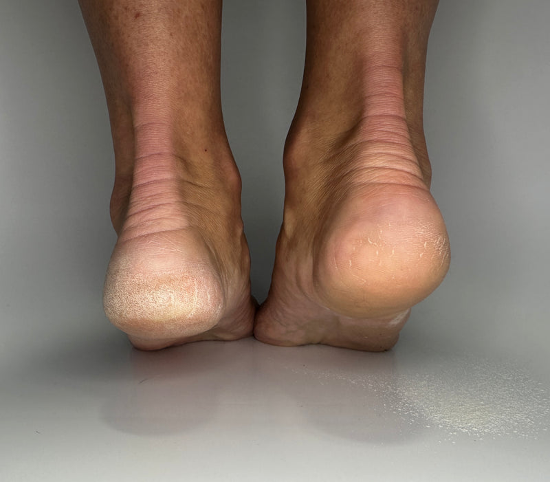 Why Your Feet Aren't So Lovely: Three Things You Need to Know to Fix Them