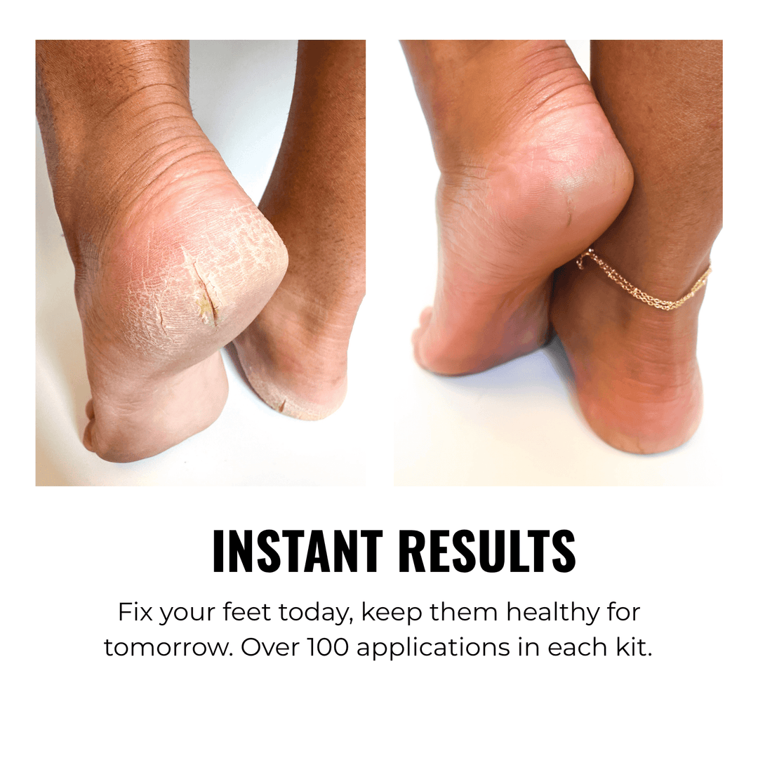 SandBar Foot Care Kit