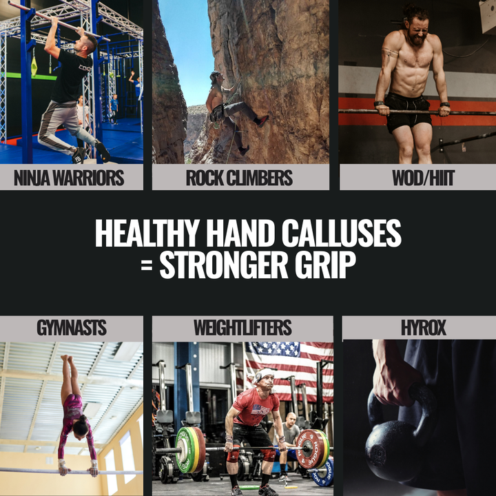 SandBar 8" Callus Kit