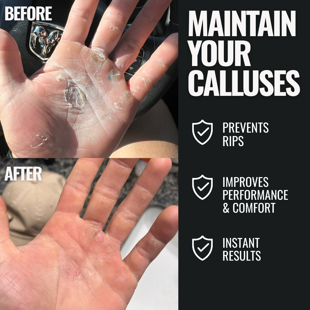 SandBar 8" Callus Kit