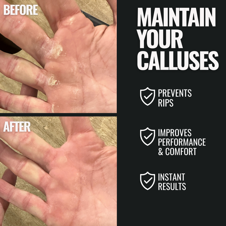 SandBar Ultimate Callus Kit