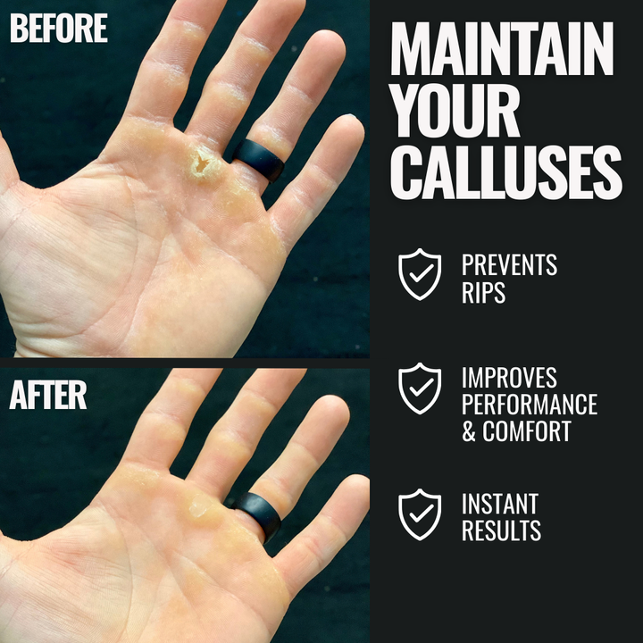SandBar 4" Quickie Callus Kit