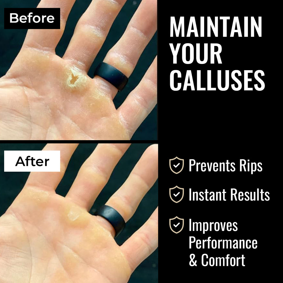 SandBar 4" Quickie Callus Kit