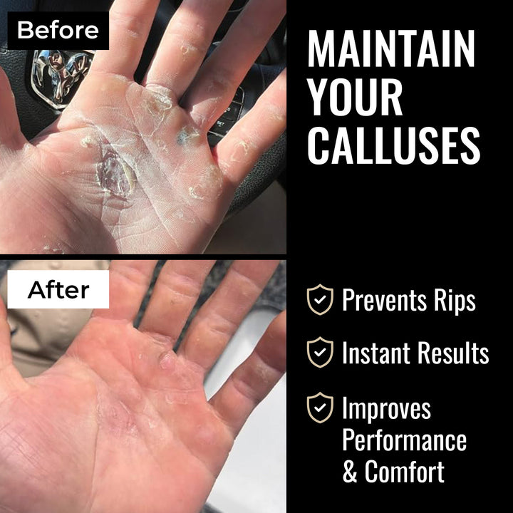 Before and after comparison of callus care with text on maintaining calluses.