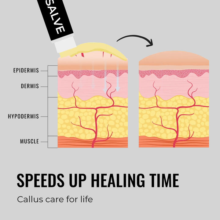 Text and graphic showing that SandBar Salve speeds up healing time of calluses, rough skin, and tears.