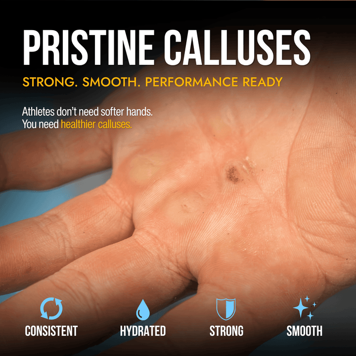 Close-up of healthy athlete hand calluses showing strong, smooth, hydrated skin maintained through consistent callus care 