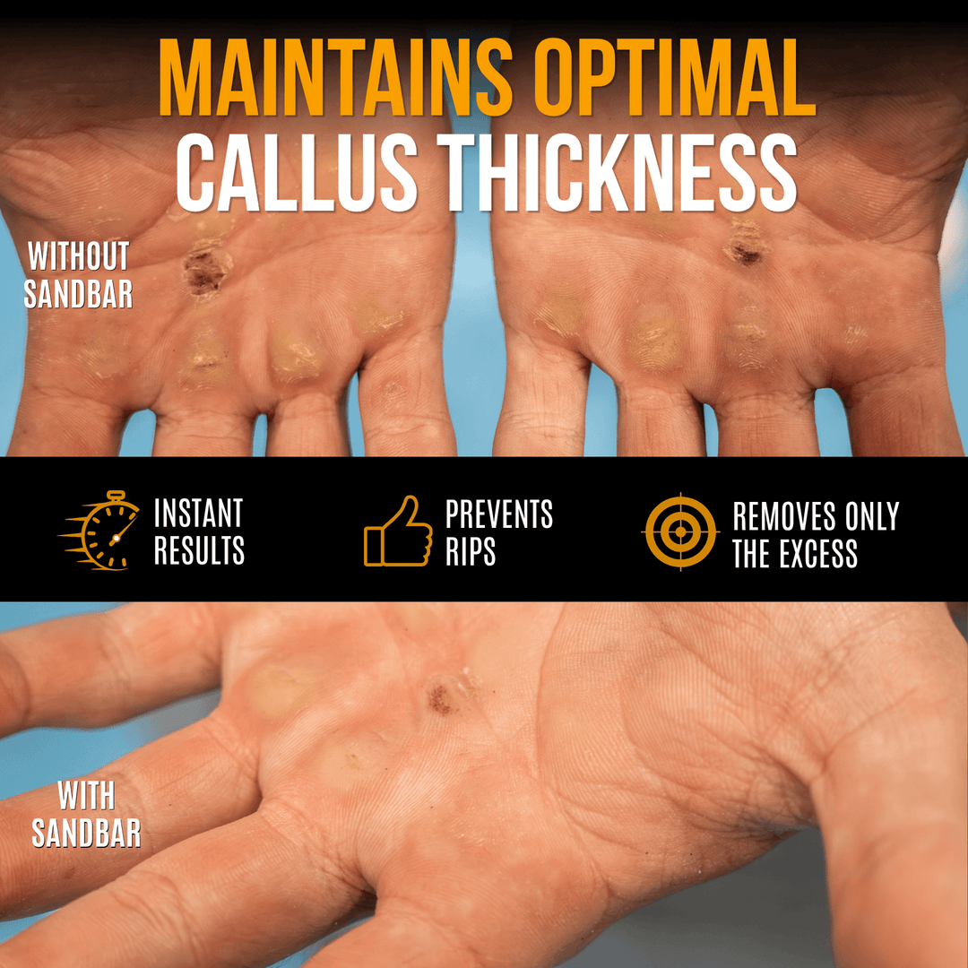 Comparison of callus thickness on hands with and without a sandbar, highlighting benefits to prevent calluses from ripping.